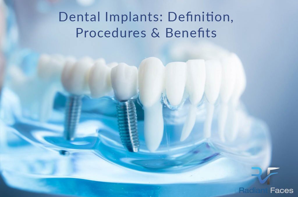 Dental Implants: Definition, Procedures, and Benefits – Bristol UK